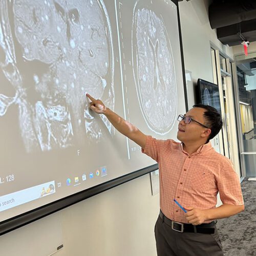 A student stands in front of a projector screen. Their body is facing the camera while their head is looking at the screen. They are wearing a light orange shirt and gray pants. There is an MRI on the screen and the student is pointing to part of it.